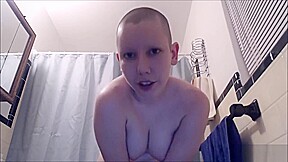 Bald girl