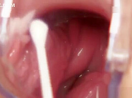 Blonde Bella Morgan visit gynoclinic to have her pussy gyno exami