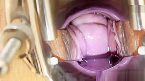 Chubby redhead gets a gyno