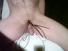 ESTIM
