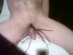 ESTIM