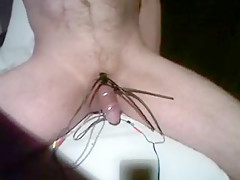ESTIM